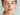 acne free skin