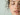 does dry skin cause acne