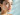 hyaluronic acid benefits