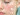 list of foods that cause acne