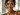 skin preparation