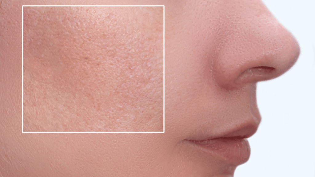 How Humidity Affects Your Skin