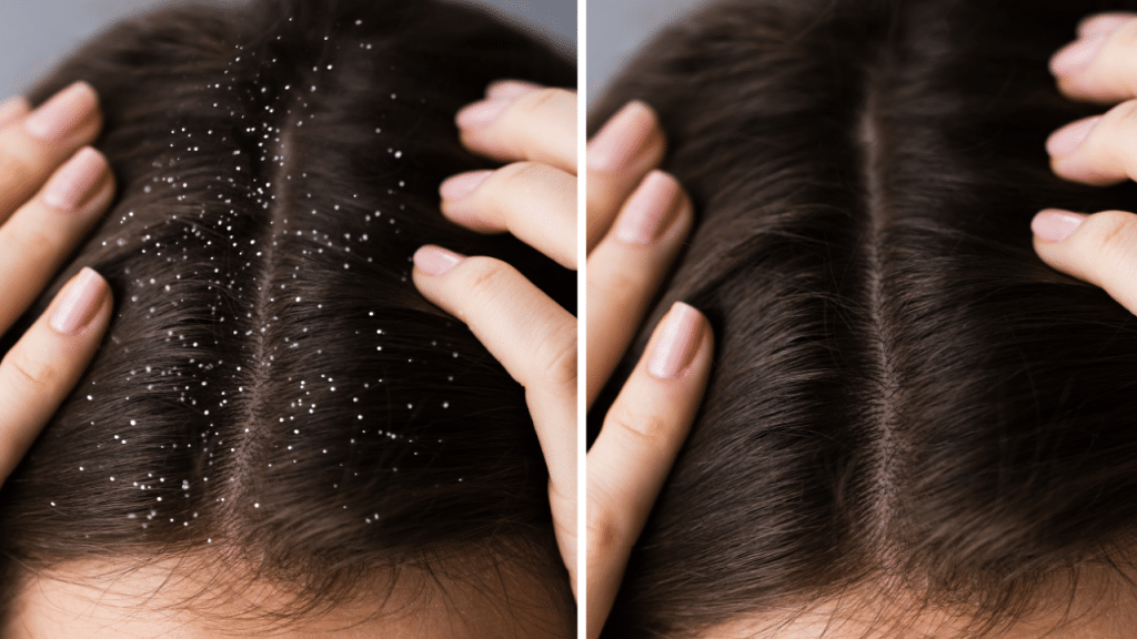 scalp care results